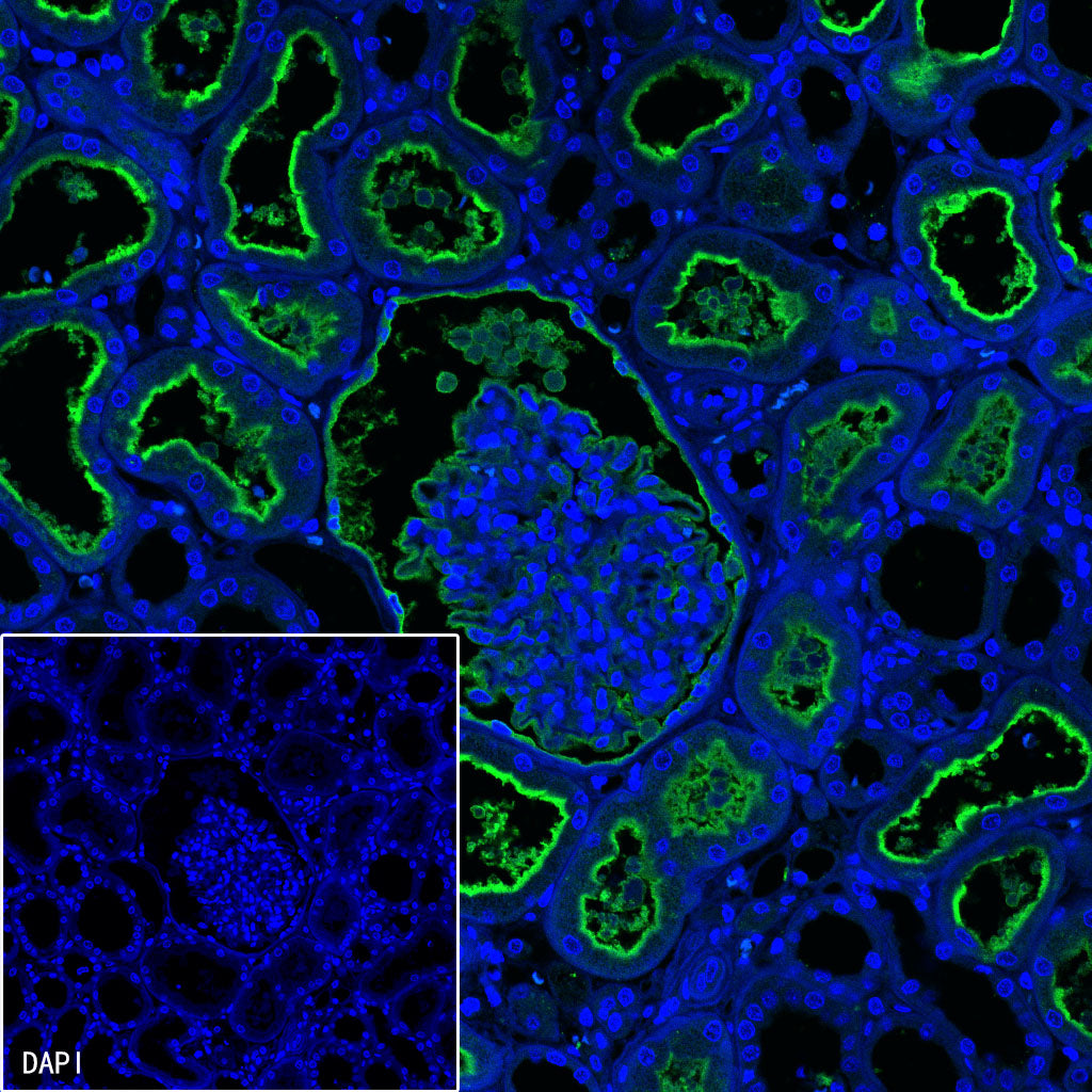 CD10 Recombinant Rabbit mAb (SDT-006-77)