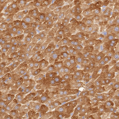 Glutathione Peroxidase 1 Recombinant Rabbit mAb (S-1714-17)
