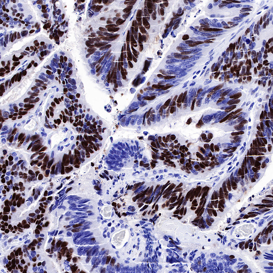 S-RMab® p53 Recombinant Rabbit mAb (SDT-R118)