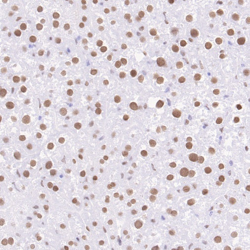 Phospho-ATF-2 (Thr71)/ATF-7 (Thr53) Recombinant Rabbit mAb (S-3535)