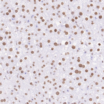 Phospho-ATF-2 (Thr71)/ATF-7 (Thr53) Recombinant Rabbit mAb (S-3535)