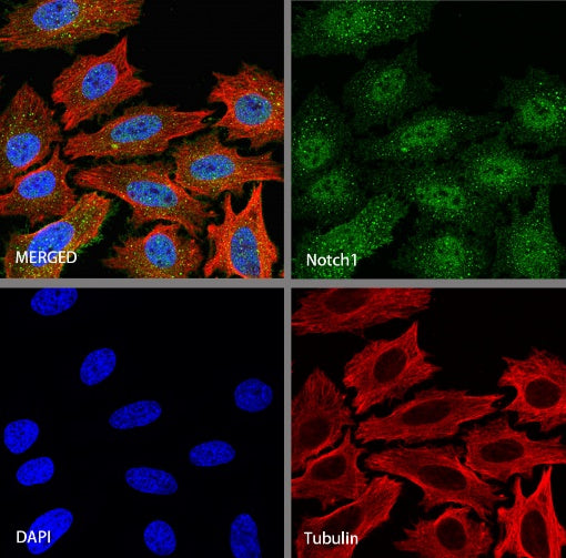 Notch1 Recombinant Rabbit mAb (S-1105-4)