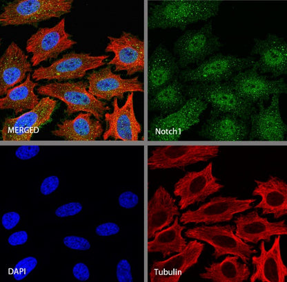 Notch1 Recombinant Rabbit mAb (S-1105-4)