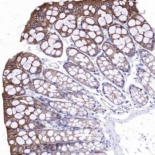 Cortactin Recombinant Rabbit mAb (S-1303-10)