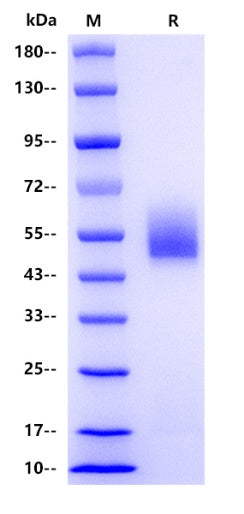 Human ZP3 Protein, His tag