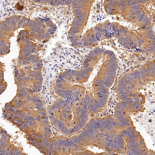 SHARPIN Recombinant Rabbit mAb (S-2356-308)