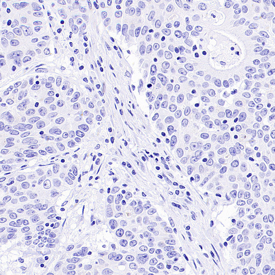 PAM Recombinant Rabbit mAb (SDT-2995-30)