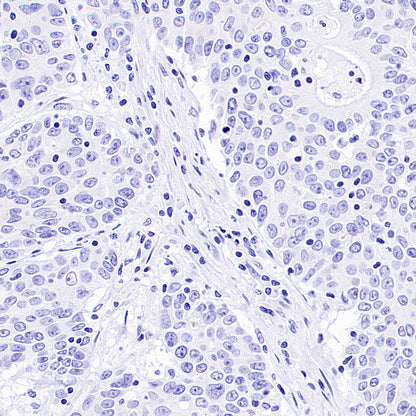 PAM Recombinant Rabbit mAb (SDT-2995-30)