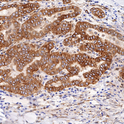 STING Recombinant Rabbit mAb (SDT-R150)