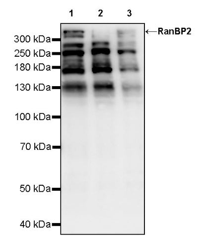RanBP2 Recombinant Rabbit mAb (S-2593-310)