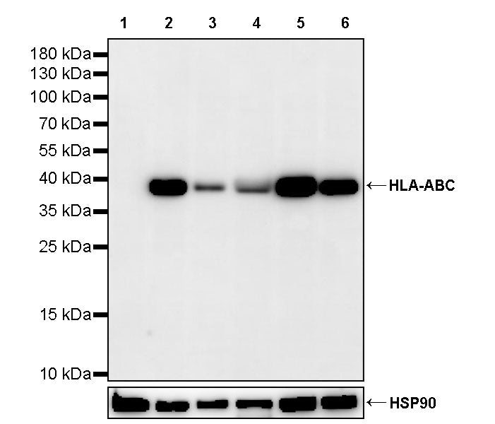 HLA-ABC Recombinant Rabbit mAb (S-3995-2)