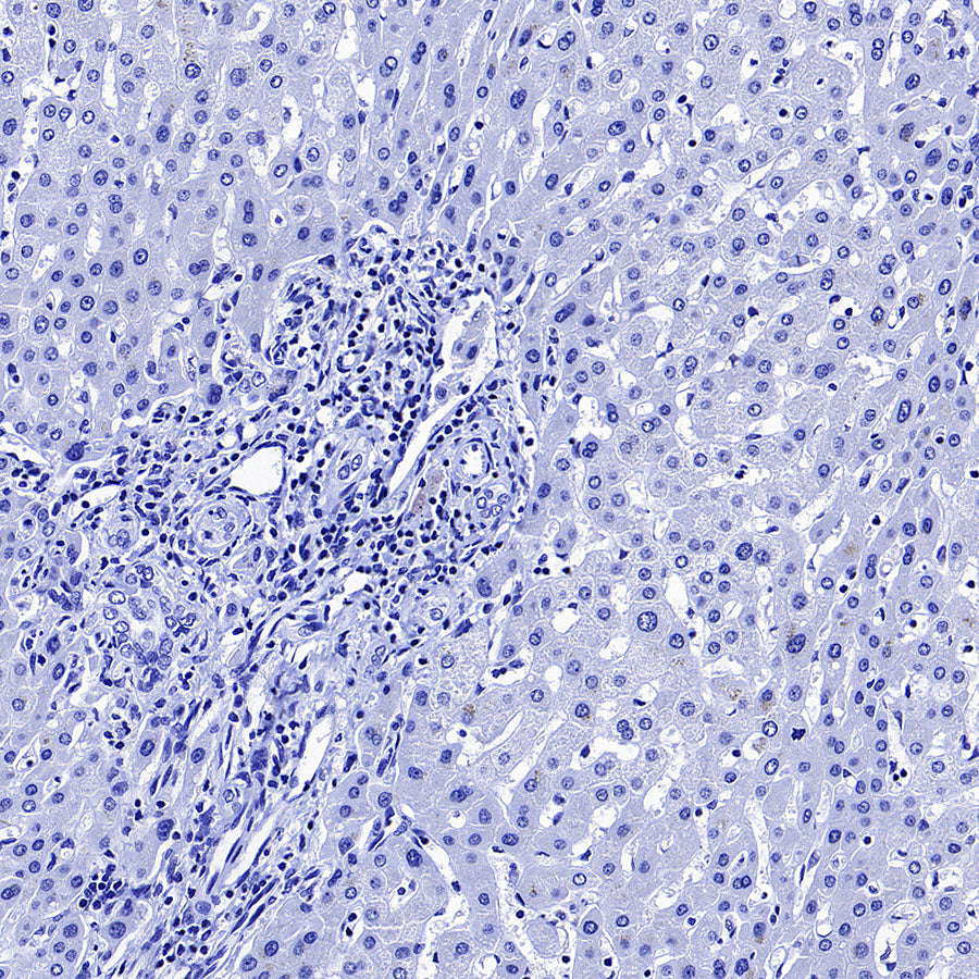 Glypican-3 Recombinant Rabbit mAb (SDT-4064-69-2)