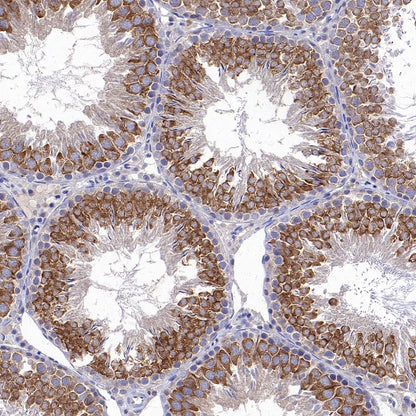 CHMP6/VPS20 Recombinant Rabbit mAb (S-1702-78)