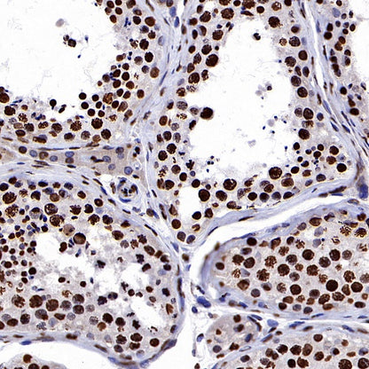 Histone H3 (di+tri methyl K79) Recombinant Rabbit mAb (S-854-48)