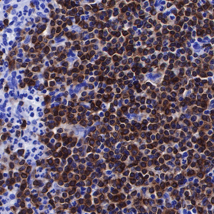 CD79a/MB-1 Recombinant Rabbit mAb (SDT-030-18)