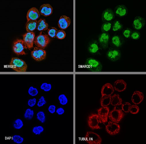 SMARCD1 Rabbit Polyclonal Antibody