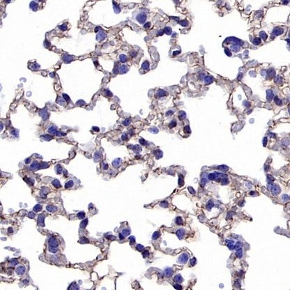 VE-Cadherin Recombinant Rabbit mAb (S-1291-239)