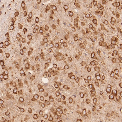 FXR1 Rabbit Polyclonal Antibody