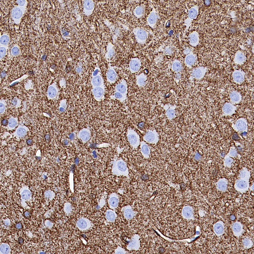 AQP4 Recombinant Rabbit mAb (S-1609-62)
