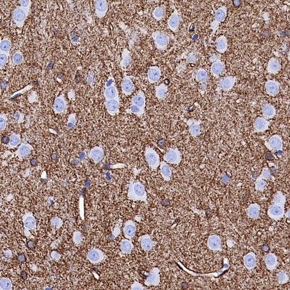 AQP4 Recombinant Rabbit mAb (S-1609-62)
