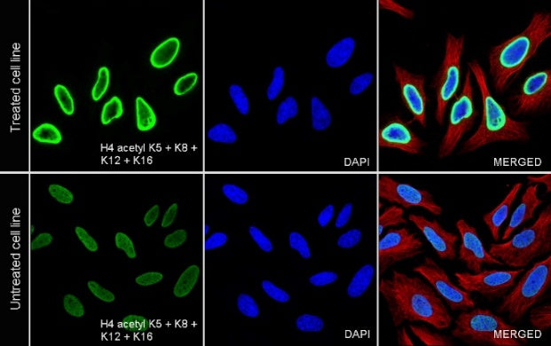 Histone H4 (acetyl K5 + K8 + K12 + K16) Recombinant Rabbit mAb (S-902-37)