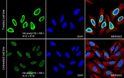 Histone H4 (acetyl K5 + K8 + K12 + K16) Recombinant Rabbit mAb (S-902-37)