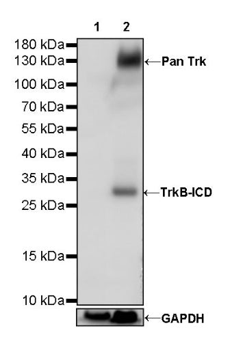 S-RMab® Pan Trk Recombinant Rabbit mAb (SDT-512-5)