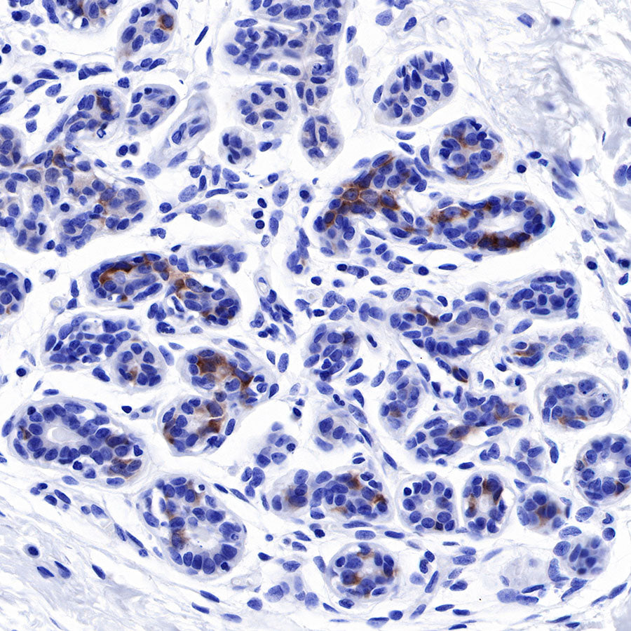 Tau Recombinant Rabbit mAb (SDT-171-67)