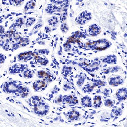 Tau Recombinant Rabbit mAb (SDT-171-67)