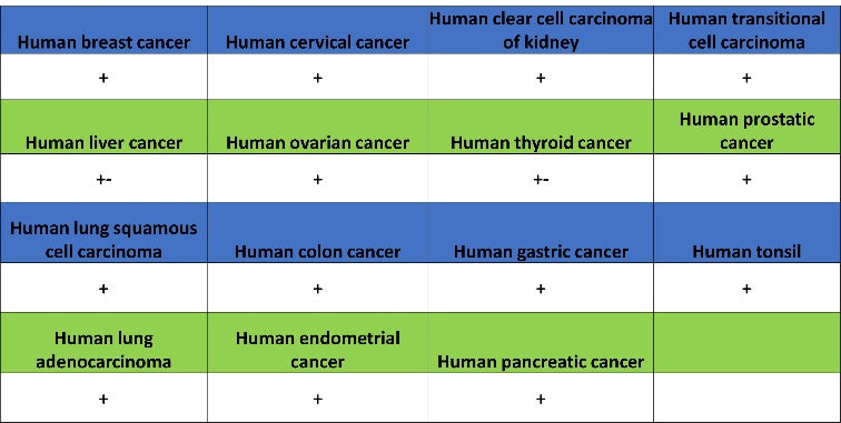 4E-BP1 Recombinant Rabbit mAb (S-1654-47)