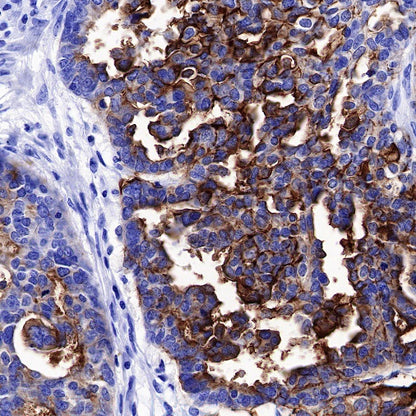 CA125 Recombinant Rabbit mAb (SDT-555-41)