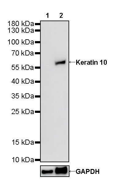Keratin 10 Recombinant Rabbit mAb (SDT-124-6)
