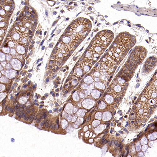 TRAF6 Recombinant Rabbit mAb (S-1087-44)