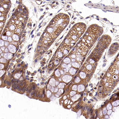 TRAF6 Recombinant Rabbit mAb (S-1087-44)