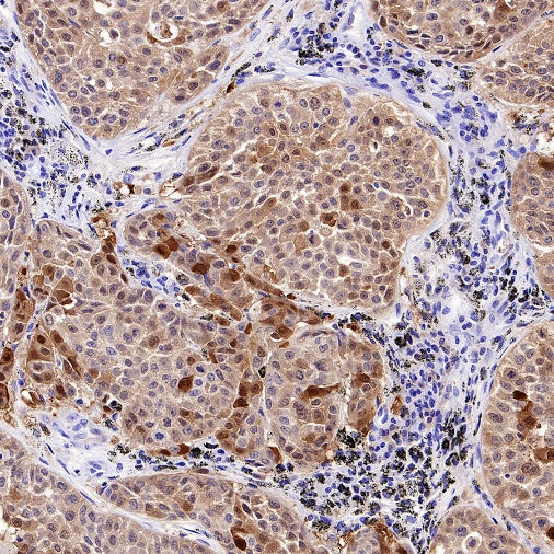 14-3-3 sigma Recombinant Rabbit mAb (S-2017-59)