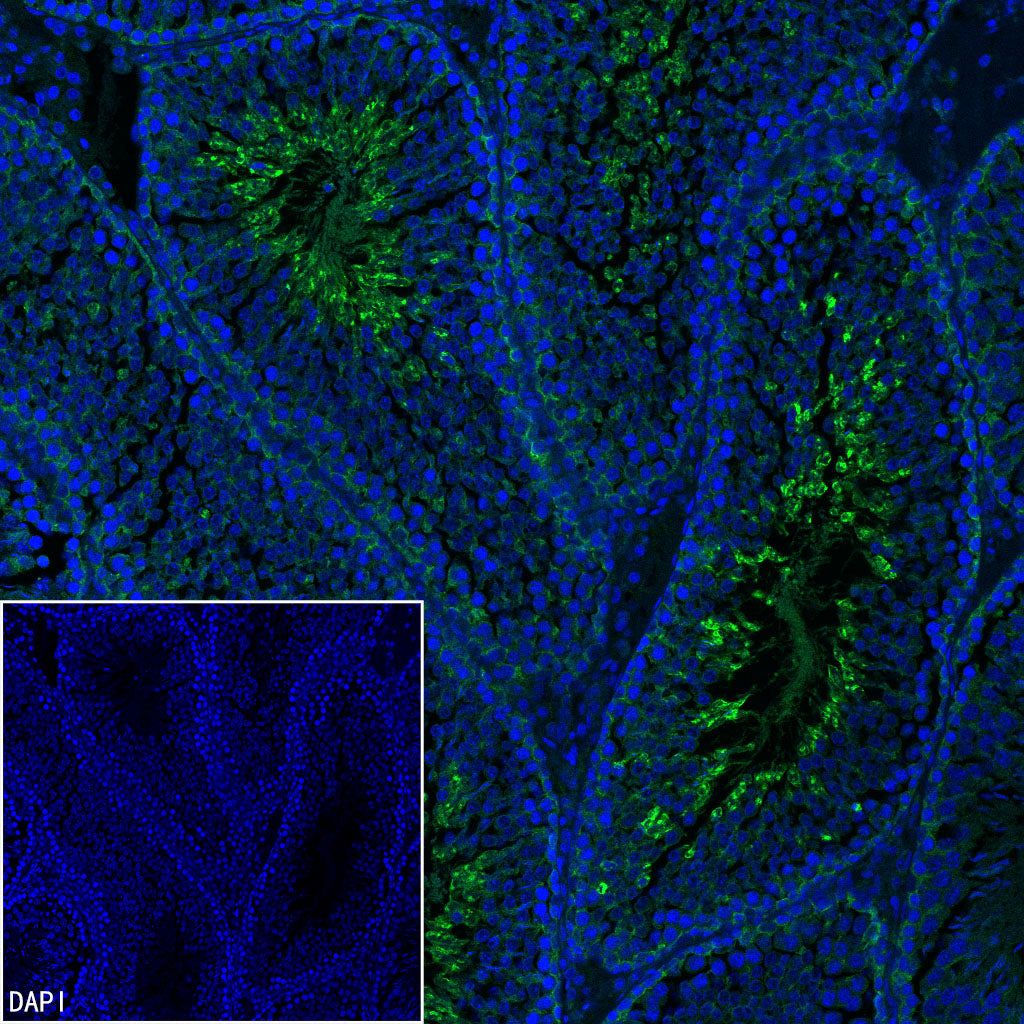 PGK1 Mouse mAb