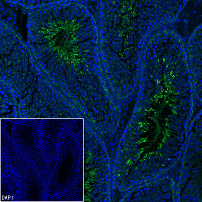 PGK1 Mouse mAb