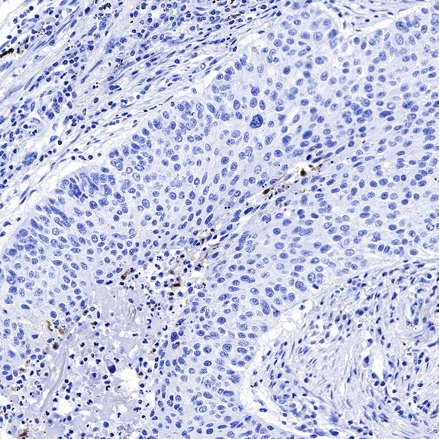 Cleaved PARP1 Recombinant Rabbit mAb,PBS Only (SDT-R084)