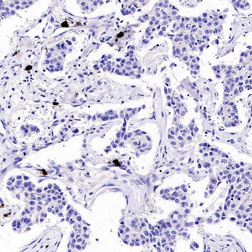 Human IgA1 Recombinant Rabbit mAb (S-2513-50)