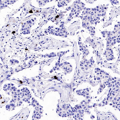Human IgA1 Recombinant Rabbit mAb (S-2513-50)