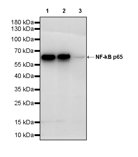 NF-kB p65 Recombinant Rabbit mAb (S-5142)