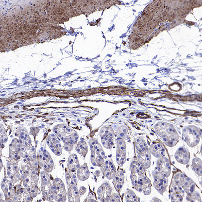 Vinculin Recombinant Rabbit mAb (S-5405)