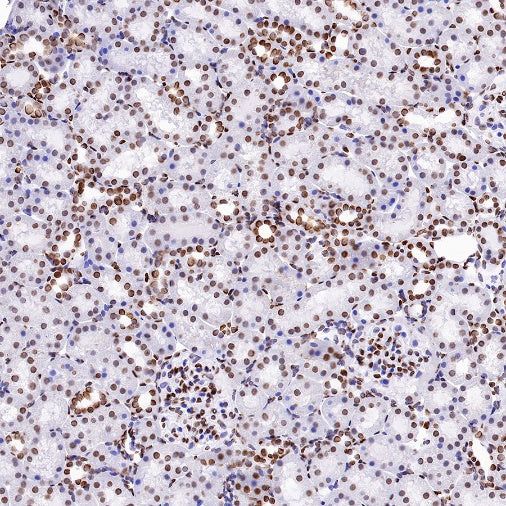 Histone H4 (acetyl K16) Recombinant Rabbit mAb (S-1482-12)