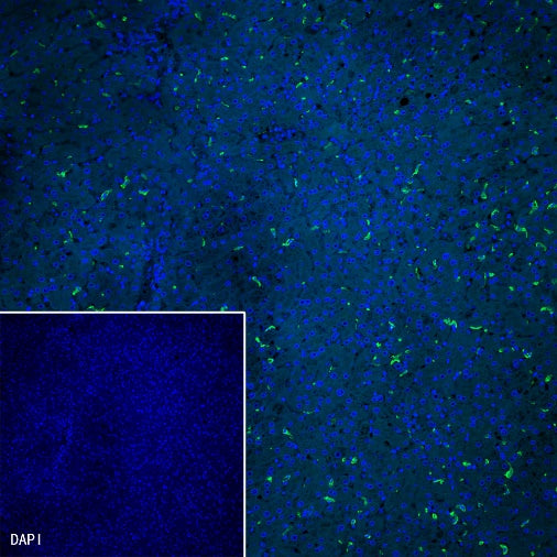 CD163 Recombinant Rabbit mAb (SDT-222-171)
