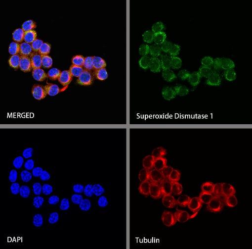 Superoxide Dismutase 1 Recombinant Rabbit mAb (S-1537-39)