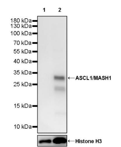 ASCL1/MASH1 Recombinant Rabbit mAb (SDT-3517-121)