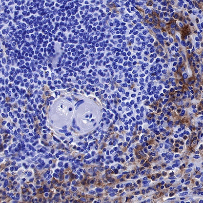 CD33 Recombinant Rabbit mAb (SDT-269-171)