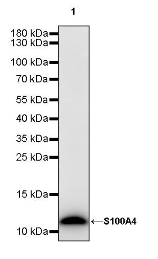S100A4 Recombinant Rabbit mAb (S-1655-26)
