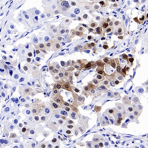 p27 Kip1 Recombinant Rabbit mAb (SDT-361-324)