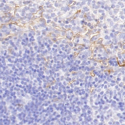 CD105 Recombinant Rabbit mAb (S-3764-11)